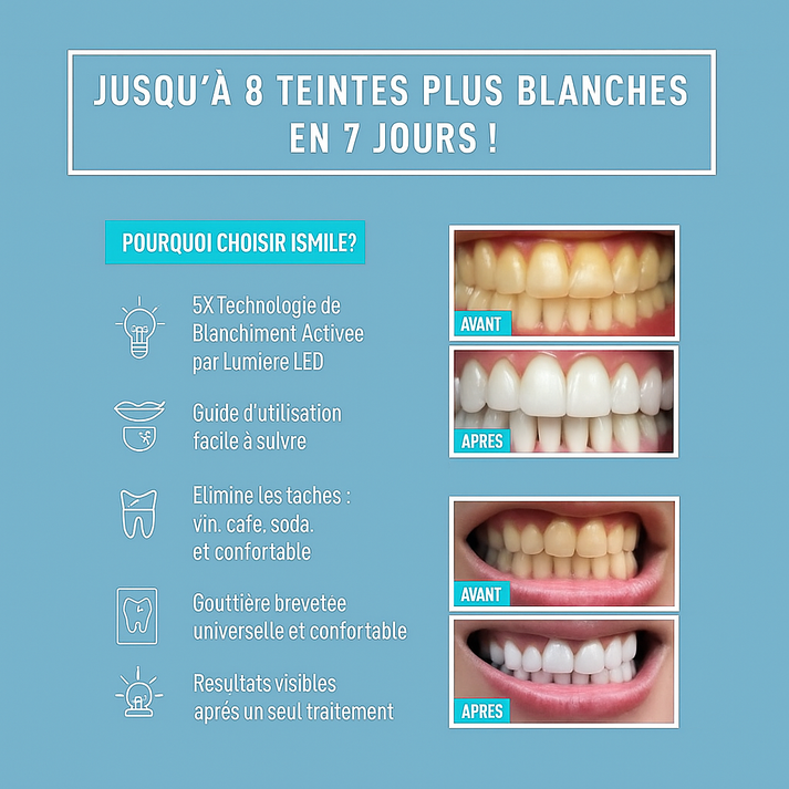 Smile Kit - élimine les taches et blanchit les dents (Résultat Garantie - Dernières pièces restantes)