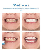 Charger l'image dans la galerie, Mousse dentaire - élimine les odeurs buccales, les taches, blanchit les dents  (résultat GARANTIE - Stock très limité)
